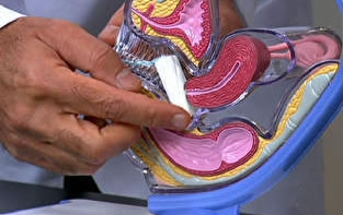 Usar roupa apertada aumenta o risco de infecções nas regiões íntimas