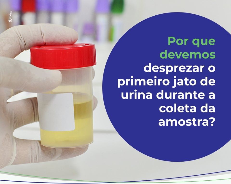 Por que devemos desprezar o primeiro jato de urina durante a coleta da amostra?