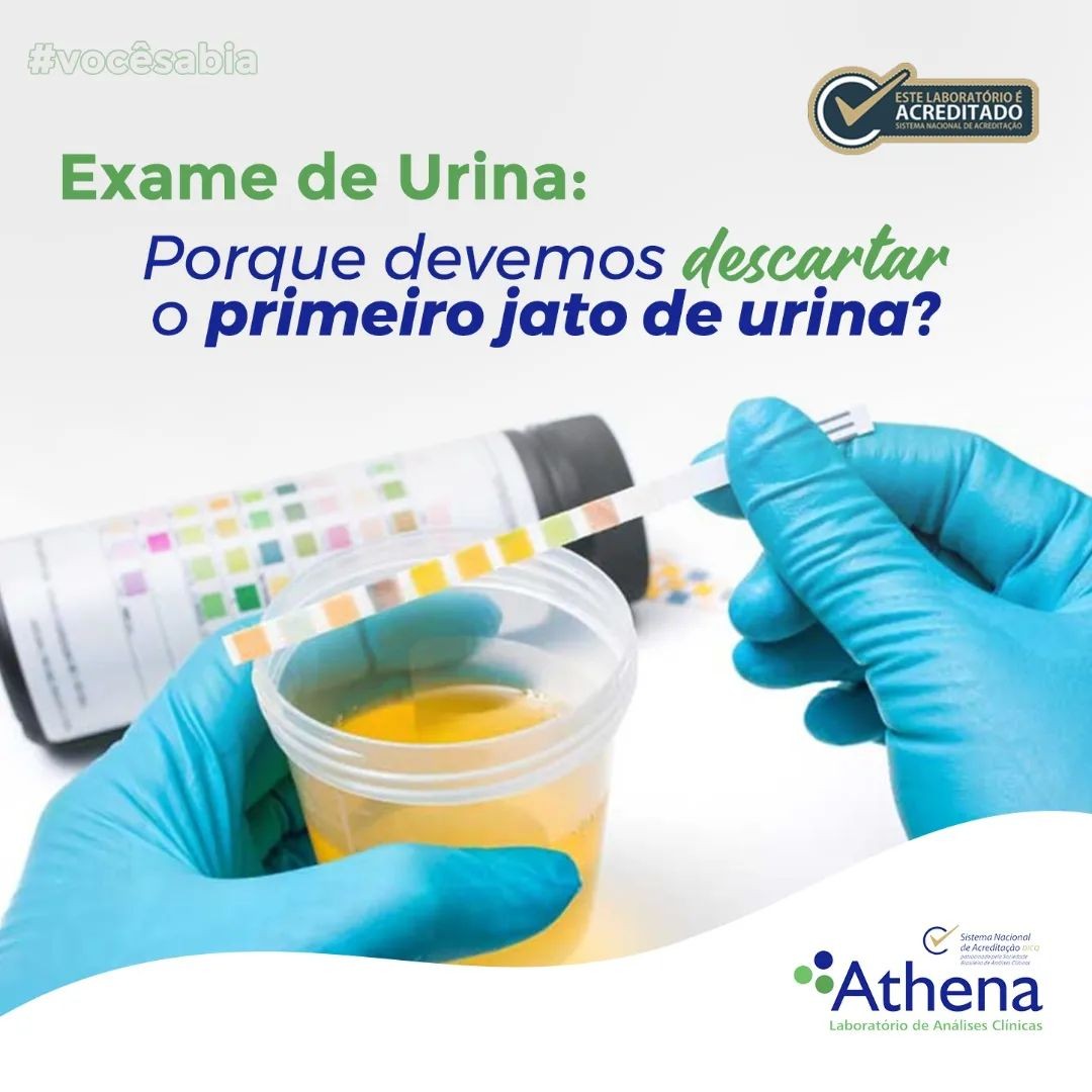 Por que devemos desprezar o primeiro jato de urina quando vamos fazer o exame?